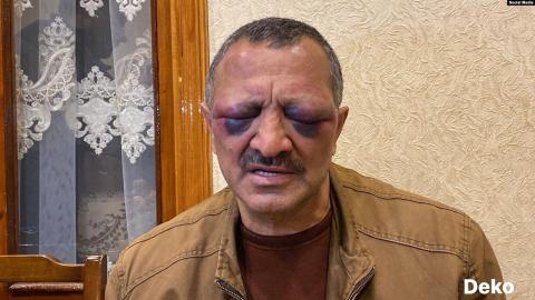 Azerbaijani opposition politician Tofik Yakublu after detention (2022)